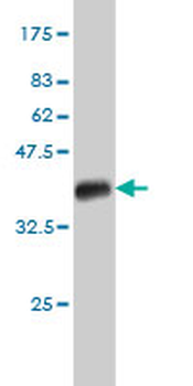 ACVR1B monoclonal antibody (M08), clone 6G11