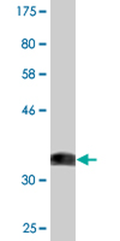 ACVR1 monoclonal antibody (M07), clone 2D5