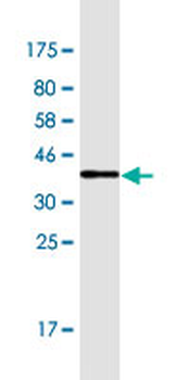 ACTN1 monoclonal antibody (M01A), clone 3F1