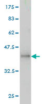 ACTN1 monoclonal antibody (M01), clone 3F1