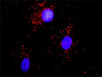 ACTN1 purified MaxPab rabbit polyclonal antibody (D01P)