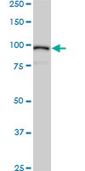 ACTN4 monoclonal antibody (M01A), clone 4D10