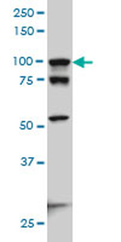 ACTN4 monoclonal antibody (M01A), clone 4D10
