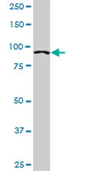ACTN4 monoclonal antibody (M01A), clone 4D10