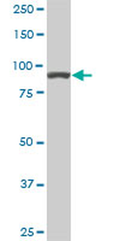 ACTN4 monoclonal antibody (M01A), clone 4D10