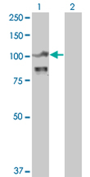 ACTN4 monoclonal antibody (M01A), clone 4D10