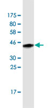 ACTN4 monoclonal antibody (M01A), clone 4D10
