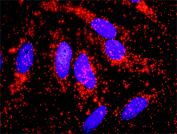 ACTN4 purified MaxPab rabbit polyclonal antibody (D01P)