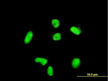 ACTN4 purified MaxPab rabbit polyclonal antibody (D01P)