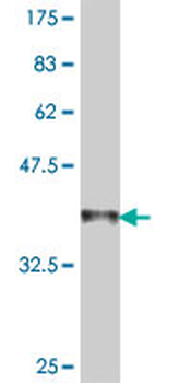 ACTG2 polyclonal antibody (A01)