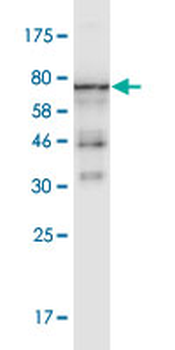 ACTB monoclonal antibody (M01A), clone 3G4-F9