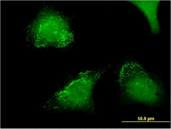 ACP5 monoclonal antibody (M01), clone 2D9