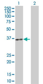 ACP5 purified MaxPab rabbit polyclonal antibody (D01P)