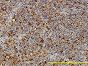 ACP2 monoclonal antibody (M01), clone M1-4A12