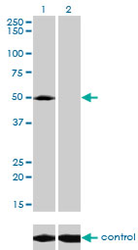 ACP2 monoclonal antibody (M01), clone M1-4A12