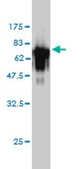 ACP2 monoclonal antibody (M01), clone M1-4A12