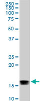 ACP1 monoclonal antibody (M06), clone 2A3