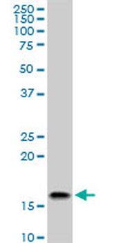 ACP1 monoclonal antibody (M06), clone 2A3