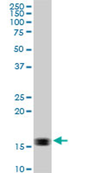 ACP1 monoclonal antibody (M06), clone 2A3