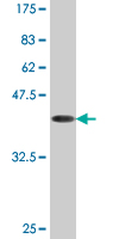 ACP1 monoclonal antibody (M06), clone 2A3