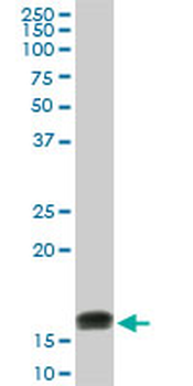 ACP1 monoclonal antibody (M01), clone 4B10