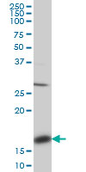 ACP1 monoclonal antibody (M01), clone 4B10