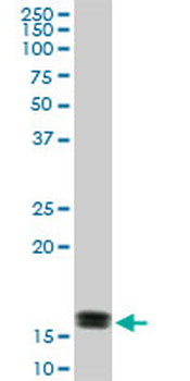 ACP1 monoclonal antibody (M01), clone 4B10