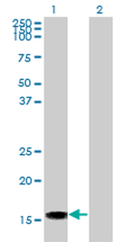 ACP1 monoclonal antibody (M01), clone 4B10