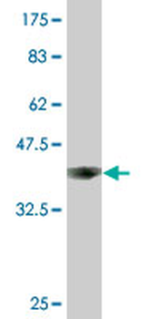 ACO1 monoclonal antibody (M01), clone 2C1