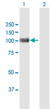 ACO1 MaxPab rabbit polyclonal antibody (D01)