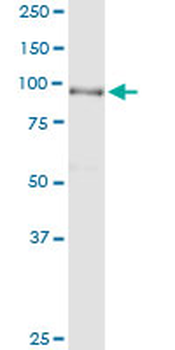 ACO1 MaxPab rabbit polyclonal antibody (D01)