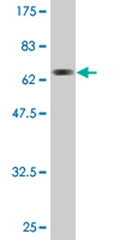 ACAT2 monoclonal antibody (M01), clone 4A5
