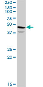 ACAT2 purified MaxPab rabbit polyclonal antibody (D01P)