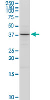 ACAT2 purified MaxPab rabbit polyclonal antibody (D01P)