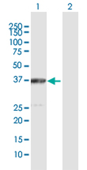 ACAT2 purified MaxPab rabbit polyclonal antibody (D01P)