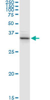 ACAT2 MaxPab rabbit polyclonal antibody (D01)