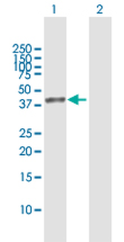 ACAT2 MaxPab rabbit polyclonal antibody (D01)