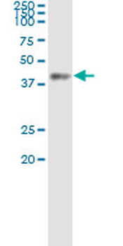 ACAT2 MaxPab rabbit polyclonal antibody (D01)