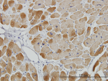 ACADVL monoclonal antibody (M01), clone 5D3