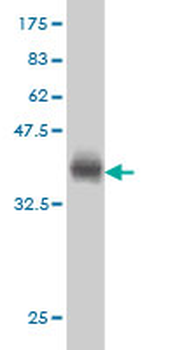 ACADVL monoclonal antibody (M01), clone 5D3
