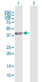 ACADS purified MaxPab mouse polyclonal antibody (B01P)