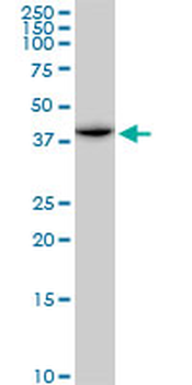 ACADM purified MaxPab mouse polyclonal antibody (B01P)