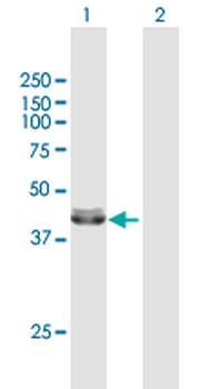 ACADM purified MaxPab mouse polyclonal antibody (B01P)