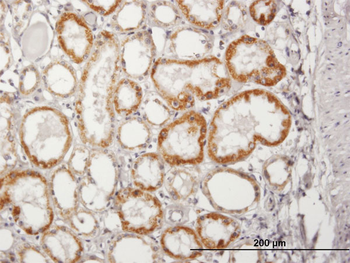ACADM purified MaxPab mouse polyclonal antibody (B01P)