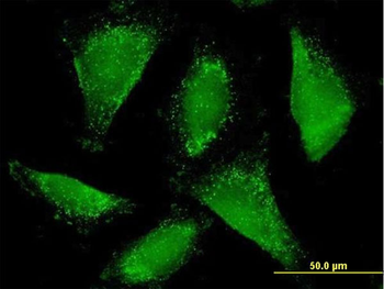 ACAA1 purified MaxPab mouse polyclonal antibody (B01P)