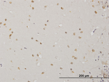 ABL2 monoclonal antibody (M09), clone 5C6