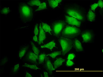 ABL2 monoclonal antibody (M09), clone 5C6