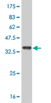 ABL2 monoclonal antibody (M09), clone 5C6