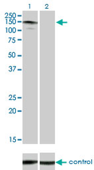 ABL2 monoclonal antibody (M03), clone 6D5