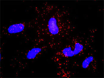 ABL2 monoclonal antibody (M03), clone 6D5